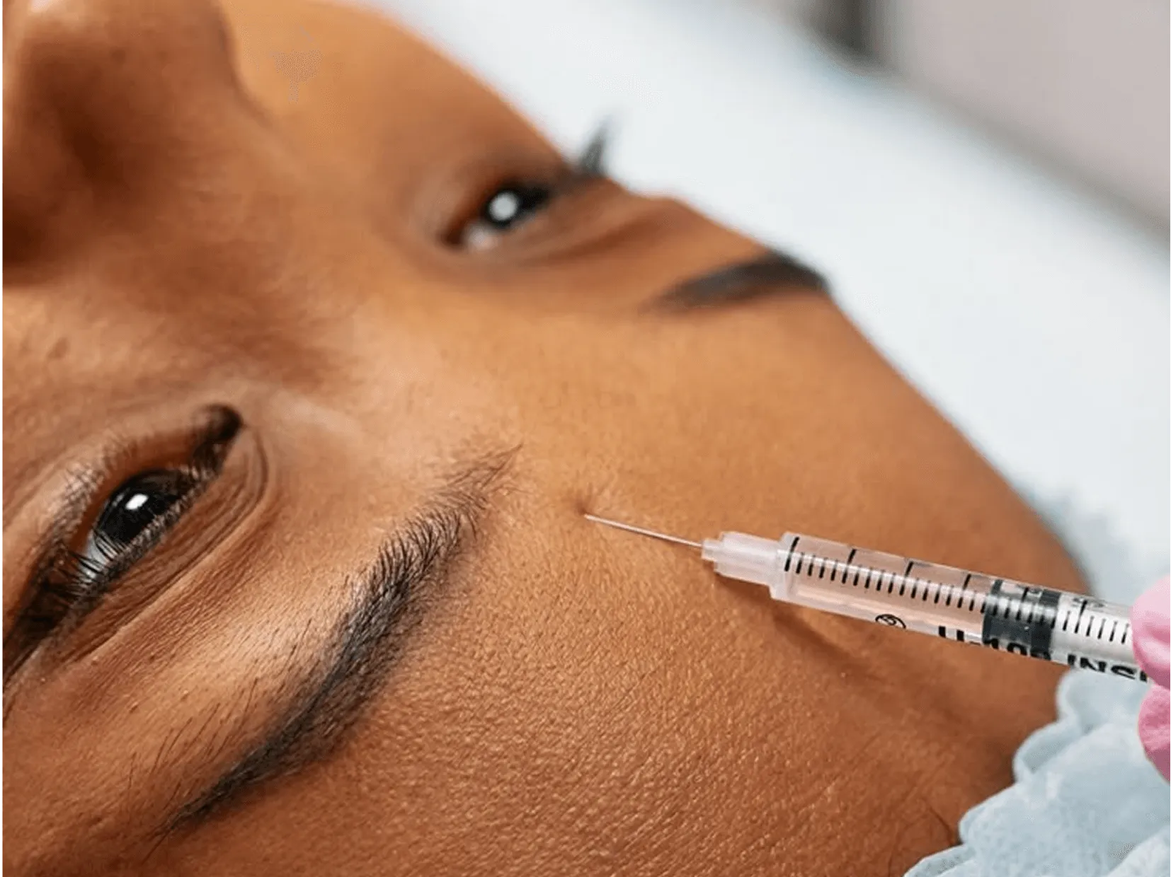 Laser Skin Treatments: What You Should Know Before You Begin